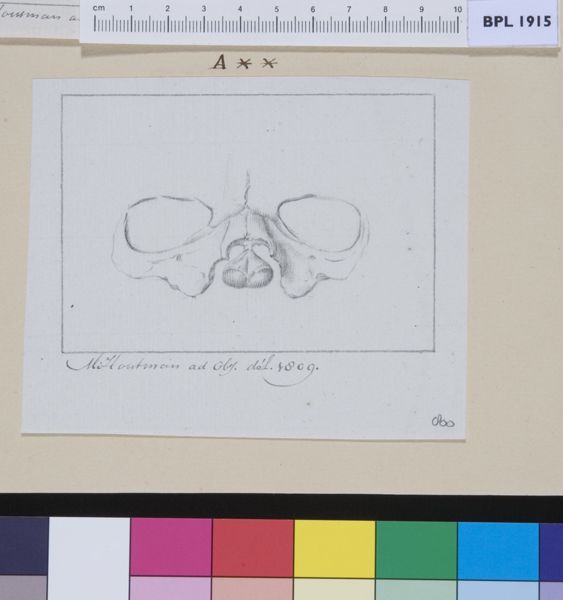 M Houtman, Skull of a child with cleft palate