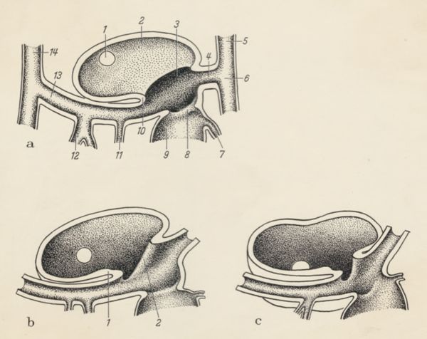 J Tinkelenberg, Embryonic heart