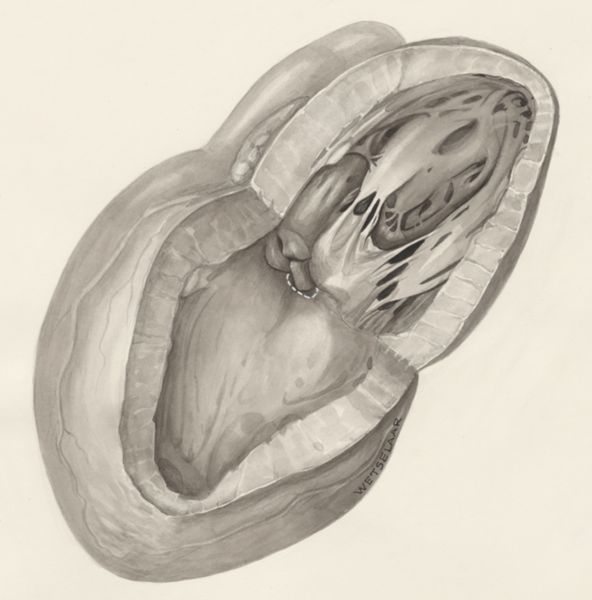 H.G Wetselaar, Heart
