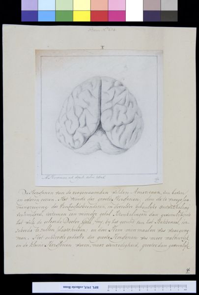 M Houtman, Brain