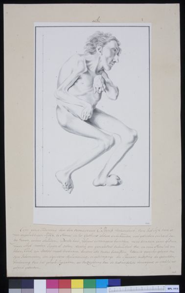Cornelis Pronk, Man with torsioned vertebrae