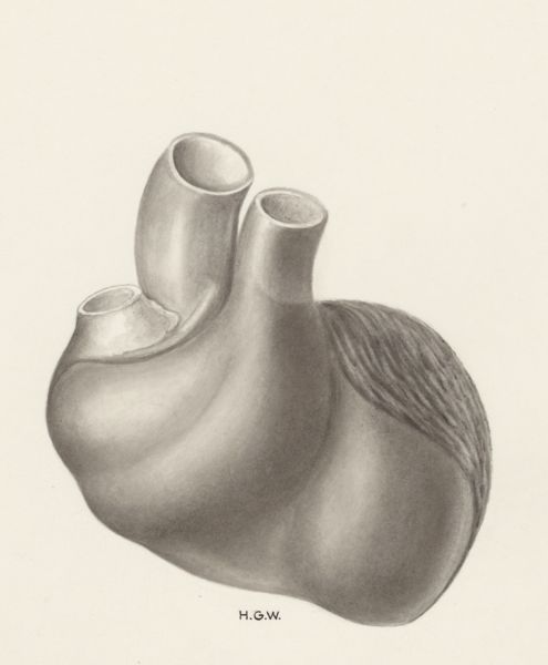 H.G Wetselaar, Heart