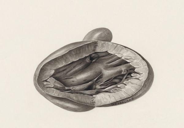 H.G Wetselaar, Heart and adjacent organs