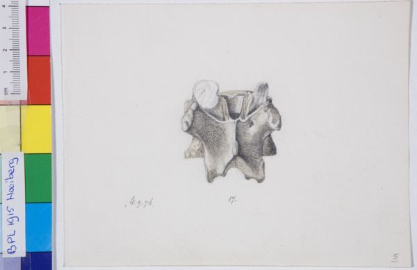 Tiemen Hooiberg, Pathology, vertebra