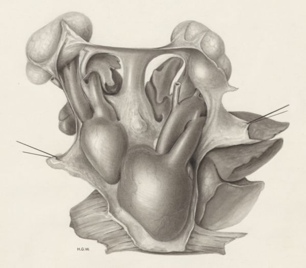 H.G Wetselaar, Heart and adjacent organs