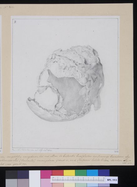 M Houtman, Fractured skull