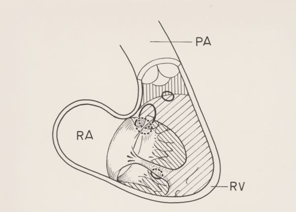 J Wetselaar-Whittaker, Cardiovascular system