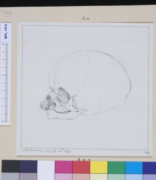 M Houtman, Skull of a child with cleft palate