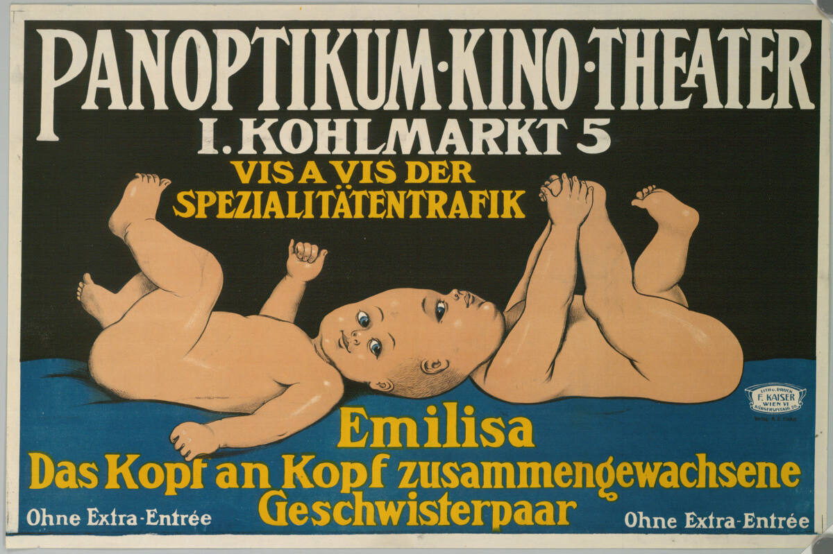 Anonym, PANOPTIKUM KINO THEATER; I. KOHLMARKT 5, Emilisa; Das Kopf an Kopf zusammengewachsene Geschwisterpaar