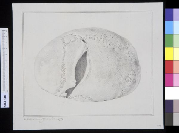 M Houtman, Skull, view from above, fracture