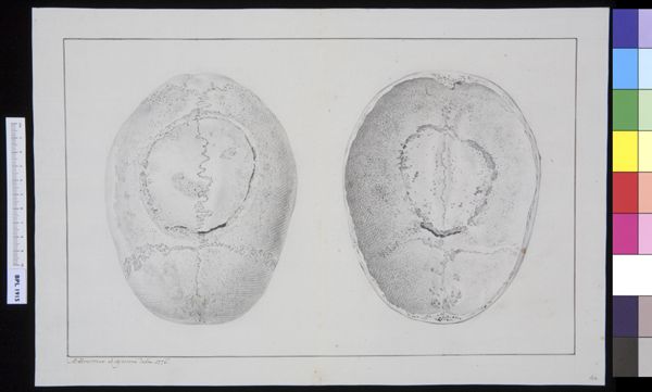 M Houtman, Skull, parietal and frontal, interior and exterior view