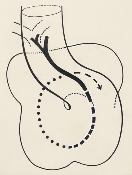 J Tinkelenberg, Schematic representation of a part of the heart
