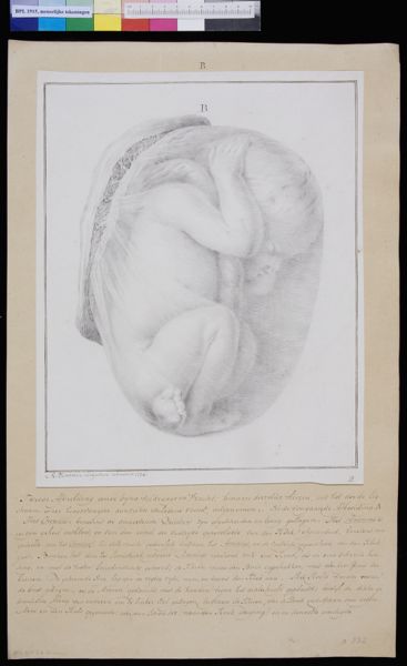 M Houtman, Foetus
