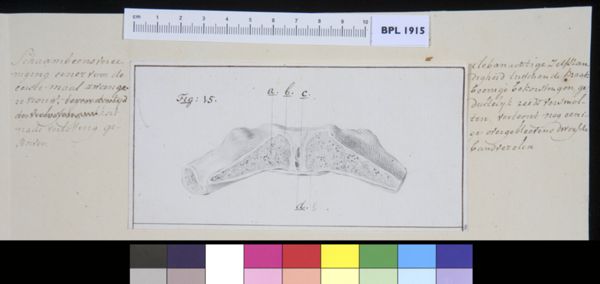 M Houtman, Pubis bone