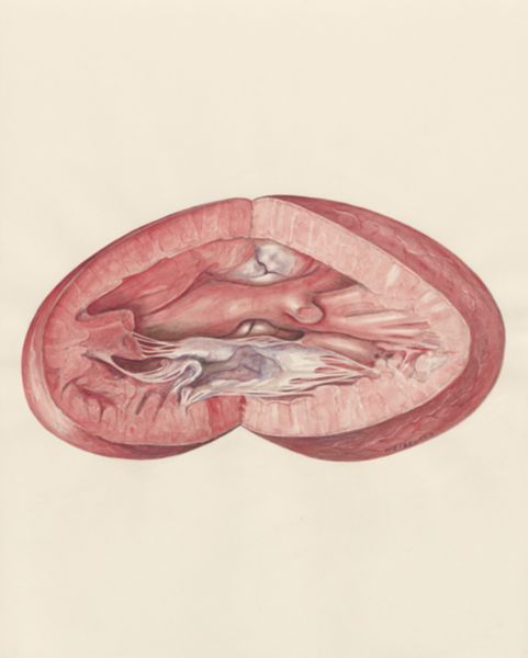H.G Wetselaar, Heart
