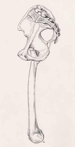J Tinkelenberg, Pelvis and upper leg bone