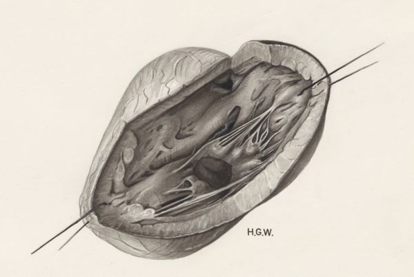 H.G Wetselaar, Heart and adjacent organs