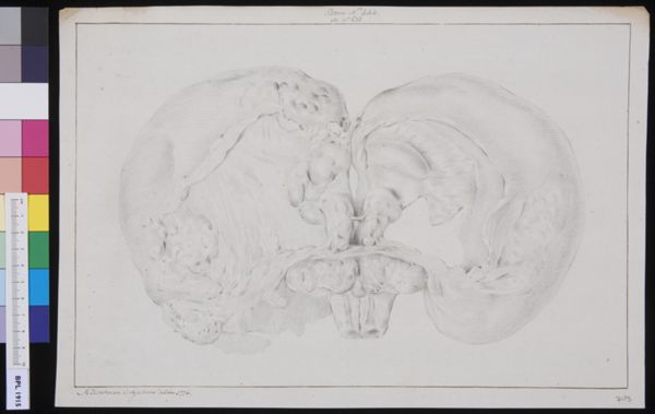 M. Houtman, Brain of a hydrocephalic calf