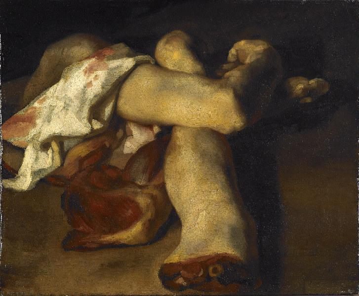 Théodore Géricault, Anatomical Pieces