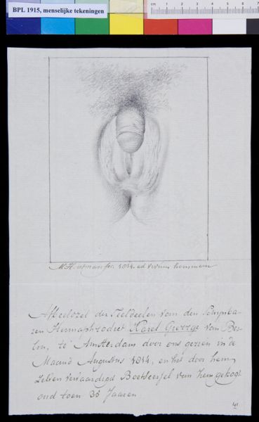 M Houtman, Genitals, hermaphrodite