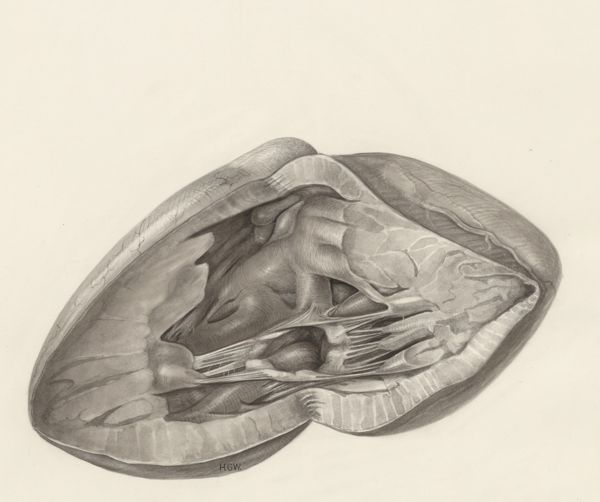 H.G Wetselaar, Heart and adjacent organs