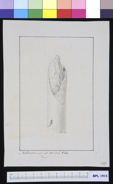 M Houtman, Infected bone