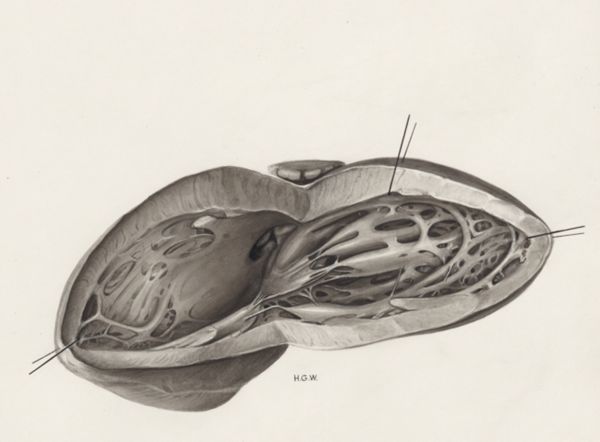 H.G Wetselaar, Heart and adjacent organs