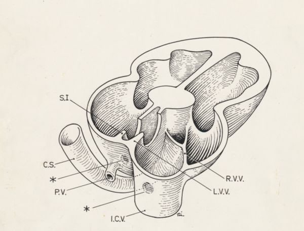 J Tinkelenberg, Embryonic heart