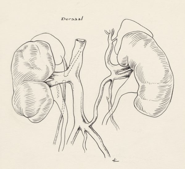J Tinkelenberg, Organs adjacent to the heart