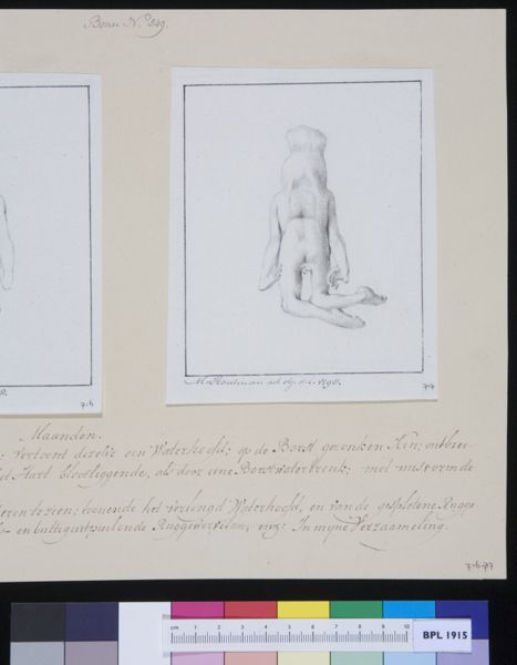 M Houtman, Deformed fetus, rear view