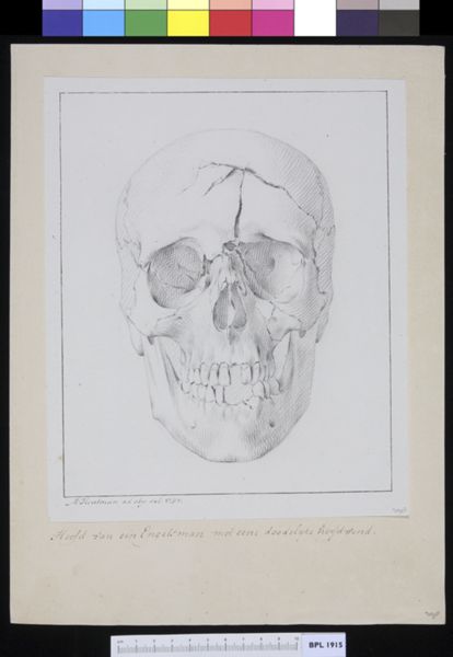 M Houtman, Human skull with fracture