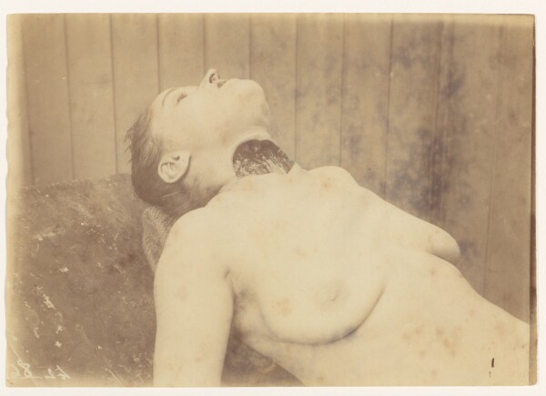 Alphonse Bertillon, Aguétant, Marie, Victime de Prado