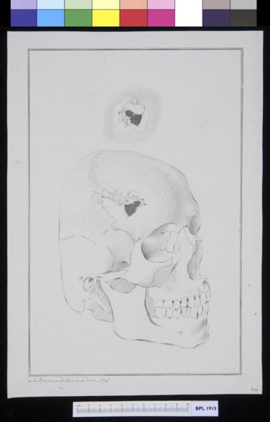M Houtman, Skull with fracture, plus detail