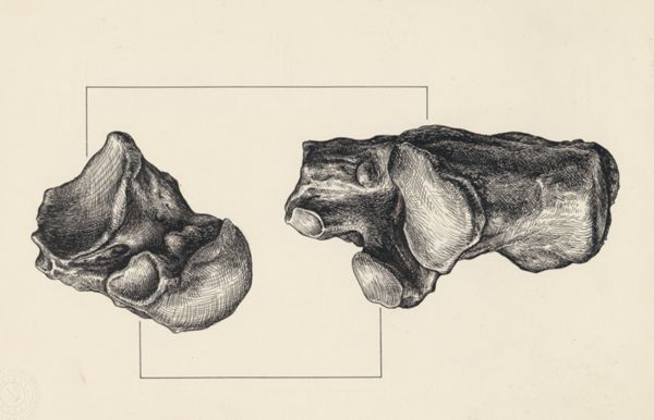 J Tinkelenberg, Musculoskeletal system of the lower extremity