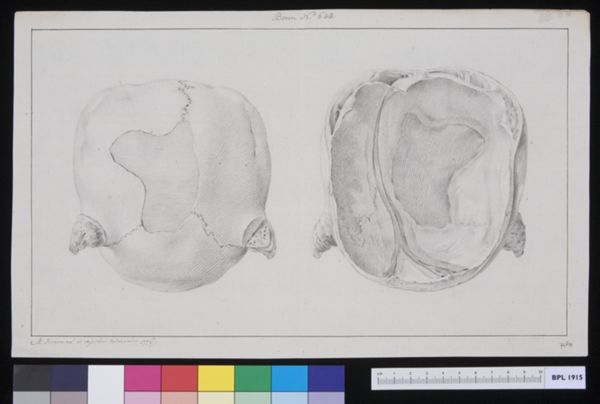 M. Houtman, Skull of a hydrocephalic calf