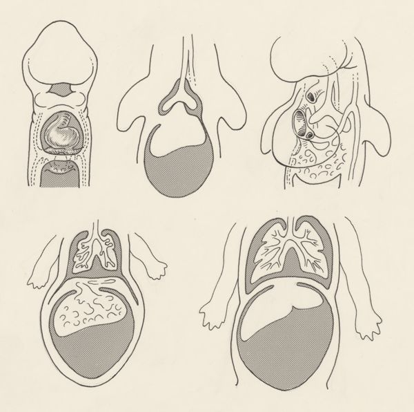 J Tinkelenberg, Stages of growth of the human embryo